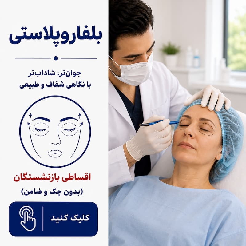 بلفاروپلاستی اقساطی